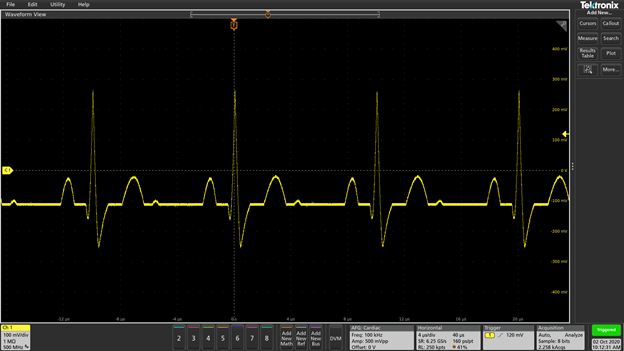 simulated heartbeat waveform on oscilloscope