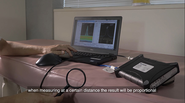 Lily MedTech Technical