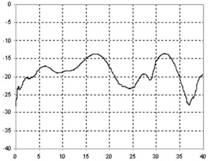 PSPL5882-Datasheet--913754-11-N